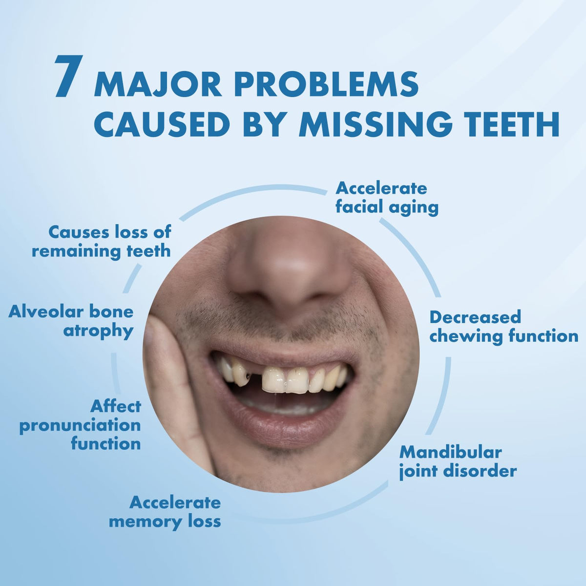 Custom Removable Dentures Set (1 Tooth) Y473