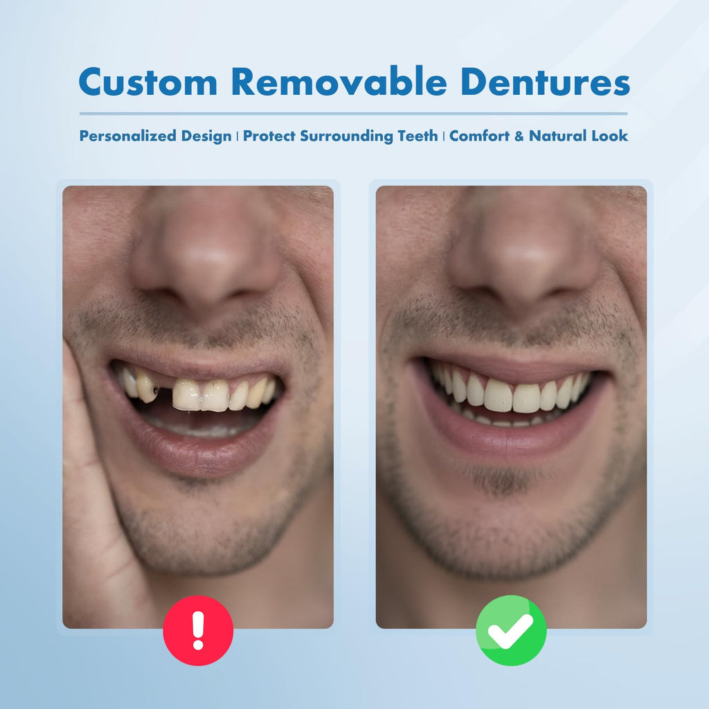 Custom Removable Dentures Set (1 Tooth) Y473