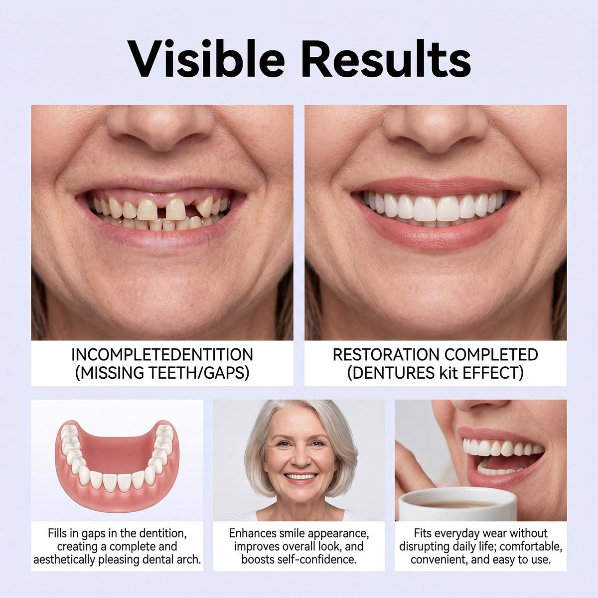 Heat Moldable Silicone Denture Kit V622