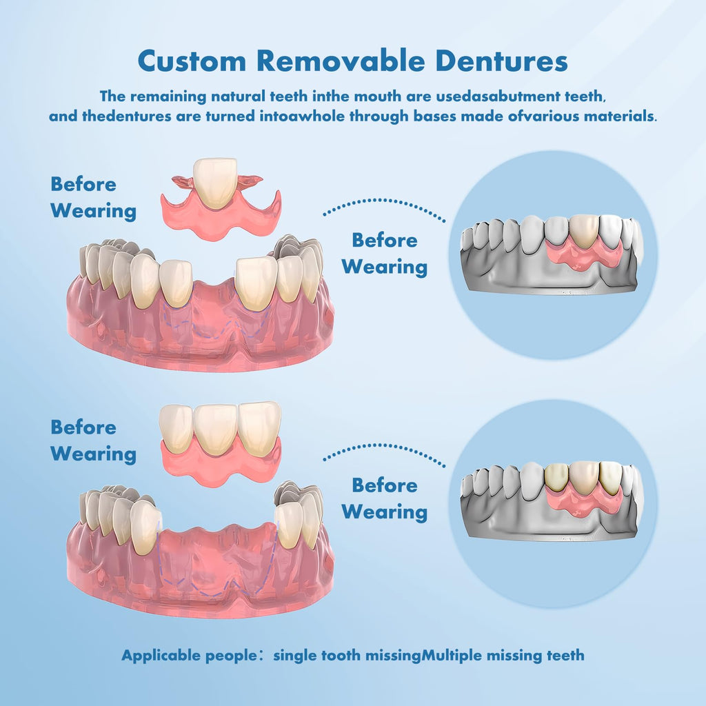 Custom Removable Dentures Set (1 Tooth) Y473