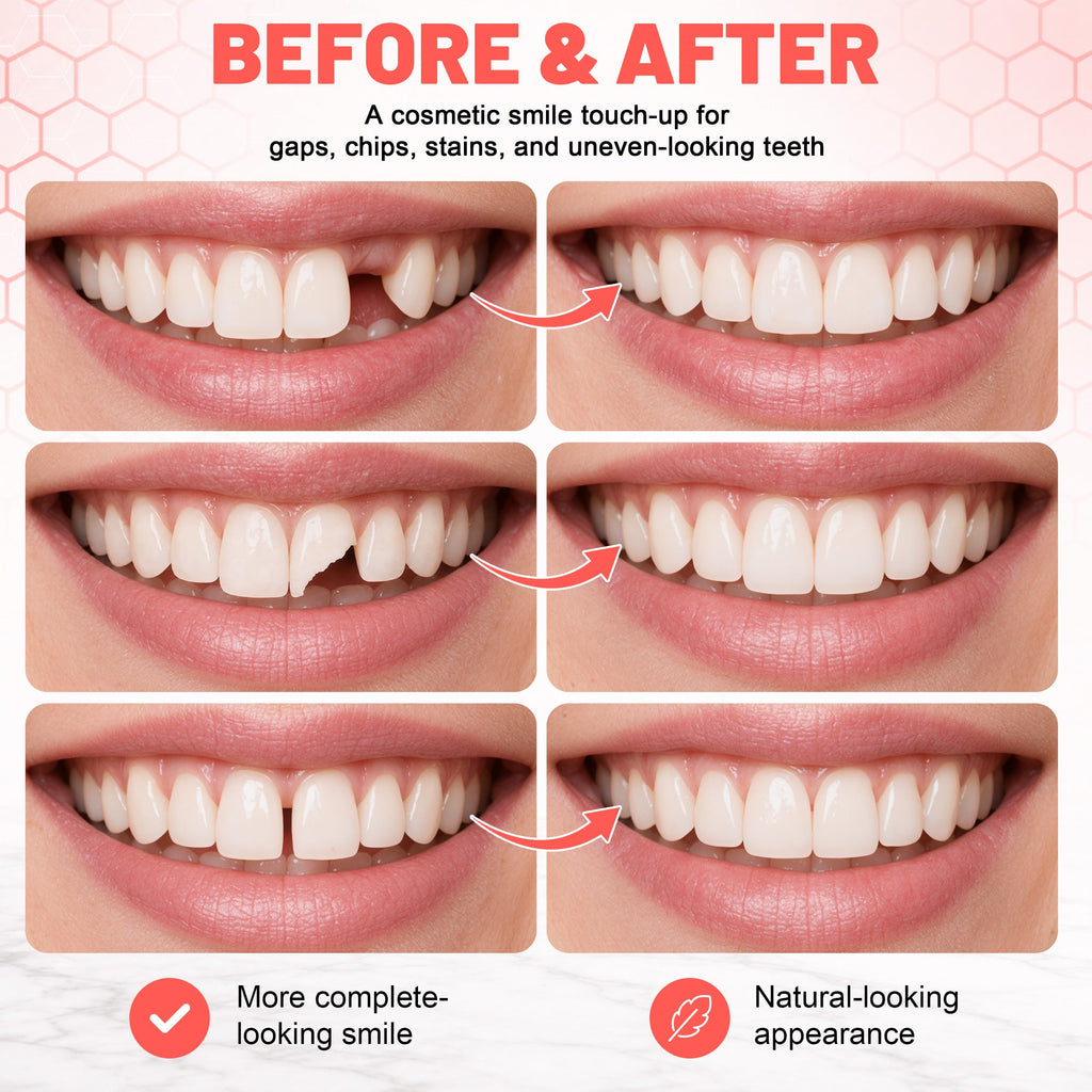 Custom Upper & Lower Dentures C126